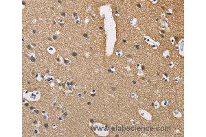Immunohistochemistry of Human brain  using PPP3CA Polyclonal Antibody at dilution of 1:40