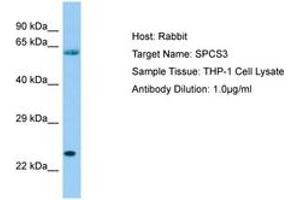 Image no. 1 for anti-Signal Peptidase Complex Subunit 3 Homolog (SPCS3) (AA 51-100) antibody (ABIN6750074) (SPCS3 Antikörper  (AA 51-100))