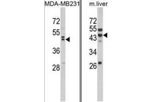 (LEFT) Western blot analysis of WNT10B Antibody (Center) in MDA-MB231 cell line lysates (35ug/lane). (WNT10B Antikörper  (Middle Region))