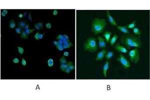 IF/ICC testing of human A) MCF7 and B) HeLa cells with DJ-1 antibody at 5ug/ml + DAPI nuclear counterstain. (PARK7/DJ1 Antikörper)