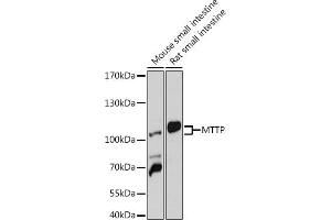 Western blot analysis of extracts of various cell lines, using MTTP antibody (ABIN6129583, ABIN6144184, ABIN6144185 and ABIN6218239) at 1:1000 dilution. (MTTP Antikörper  (AA 1-130))