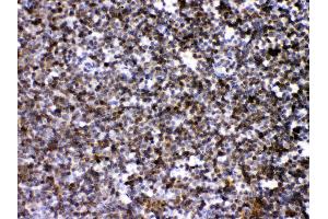 ARHGEF1 was detected in paraffin-embedded sections of mouse lymphaden tissues using rabbit anti- ARHGEF1 Antigen Affinity purified polyclonal antibody (Catalog # ) at 1 ? (ARHGEF1 Antikörper  (N-Term))