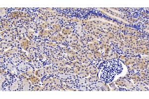 Detection of gp130 in Porcine Kidney Tissue using Polyclonal Antibody to Glycoprotein 130 (gp130) (CD130/gp130 Antikörper  (AA 392-566))