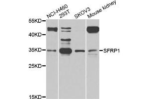 Western blot analysis of extracts of various cell lines, using SFRP1 antibody (ABIN5975810) at 1/1000 dilution. (SFRP1 Antikörper)