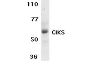 Image no. 1 for anti-TRAF3 Interacting Protein 2 (TRAF3IP2) (AA 554-568) antibody (ABIN205307) (TRAF3IP2 Antikörper  (AA 554-568))