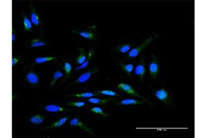 Immunofluorescence of purified MaxPab antibody to SCYL1BP1 on HeLa cell. (GORAB Antikörper  (AA 1-246))