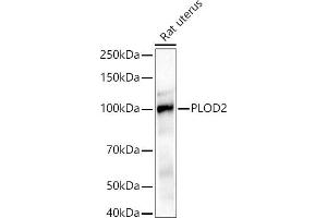 Western blot analysis of extracts of Rat uterus, using PLOD2/LH2 antibody (ABIN6132888, ABIN6145788, ABIN6145790 and ABIN6222693) at 1:1000 dilution. (PLOD2 Antikörper  (AA 470-650))
