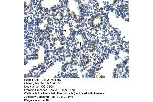 Rabbit Anti-PCBP2 Antibody  Paraffin Embedded Tissue: Human Lung Cellular Data: Alveolar cells Antibody Concentration: 4. (PCBP2 Antikörper  (Middle Region))