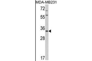 Western blot analysis of HPGD Antibody (C-term) in MDA-MB231 cell line lysates (35ug/lane).