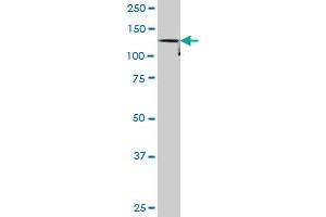 DDEF1 monoclonal antibody (M02), clone 1B5. (ASAP1 Antikörper  (AA 1030-1129))