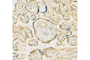 Immunohistochemistry (Paraffin-embedded Sections) (IHC (p)) image for anti-Ephrin B3 (EFNB3) antibody (ABIN7073845)