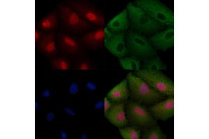 ABIN6257593 and ABIN6274990 staining  cells by IF/ICC. (CEP57 Antikörper  (Internal Region))