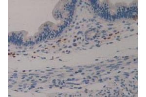 IHC-P analysis of Mouse Uterus Tissue, with DAB staining. (Klotho Antikörper  (AA 516-955))