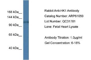 Western Blotting (WB) image for anti-Hexokinase 1 (HK1) (N-Term) antibody (ABIN2788663) (Hexokinase 1 Antikörper  (N-Term))