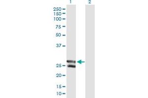 Western Blot analysis of C12orf72 expression in transfected 293T cell line by C12orf72 MaxPab polyclonal antibody. (METTL20 Antikörper  (AA 1-262))