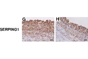 Protein localization of SERPINA5, SERPINB6, SERPINF2 and SERPING1 in E2-active and E2-inactive follicles.