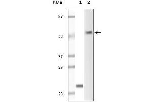 Western Blotting (WB) image for anti-Lymphocyte-Specific Protein tyrosine Kinase (LCK) (truncated) antibody (ABIN2464076) (LCK Antikörper  (truncated))