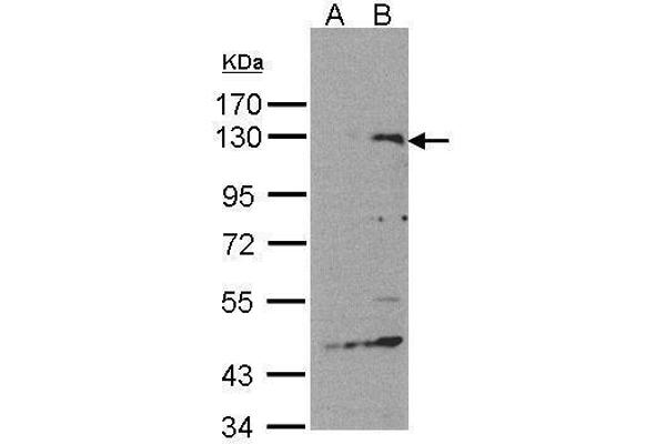 SIPA1 Antikörper  (C-Term)