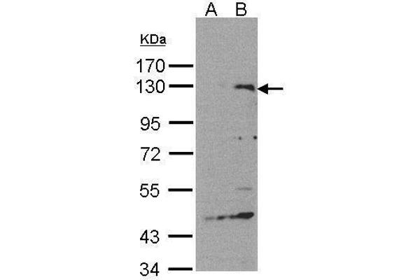 SIPA1 anticorps  (C-Term)
