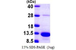 SDS-PAGE (SDS) image for S100 Calcium Binding Protein A5 (S100A5) (AA 1-92) protein (His tag) (ABIN667887)