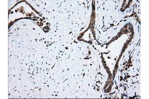 Immunohistochemical staining of paraffin-embedded Human prostate tissue using anti-TBXAS1 mouse monoclonal antibody. (TBXAS1 Antikörper)