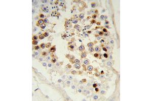 Formalin-fixed and paraffin-embedded human testis tissue reacted with SNAI Antibody, which was peroxidase-conjugated to the secondary antibody, followed by DAB staining. (SNAI Antikörper)