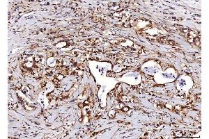 IHC analysis of ENO1 using anti-ENO1 antibody (ABIN7601902).