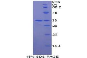SDS-PAGE analysis of Human GAB3 Protein.