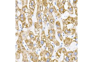 Immunohistochemistry of paraffin-embedded human liver using ACADS / SCAD Rabbit mAb (ABIN7265419) at dilution of 1:50 (40x lens). (ACADS Antikörper)