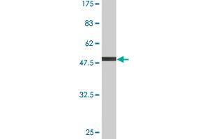 Western Blot detection against Immunogen (55. (GCLM Antikörper  (AA 1-274))