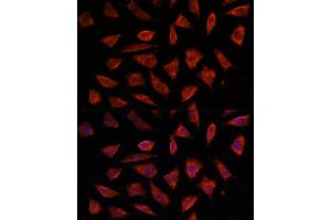 Immunofluorescence (IF) image for anti-Signal Transducing Adaptor Molecule (SH3 Domain and ITAM Motif) 2 (STAM2) (AA 376-525) antibody (ABIN6148550)