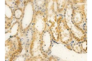 ABIN6259615 and ABIN6275472 at 1/100 staining human normal kidney tissue by IHC-P. (WTH3DI Antikörper  (Internal Region))