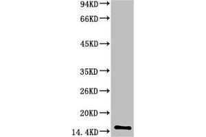 Western blot analysis of Human Serum using TTR Mouse mAb diluted at 1:2000 (TTR Antikörper)