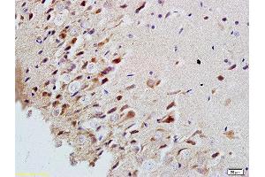 Formalin-fixed and paraffin embedded rat brain labeled with Rabbit Anti-MAP2/MAP-2a. (MAP2 Antikörper  (AA 1-120))