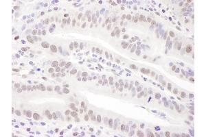 anti-Pre-mRNA Processing Factor 31 (PRPF31) (AA 449-499) antibody