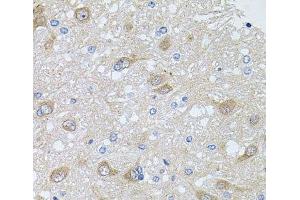 Immunohistochemistry of paraffin-embedded Rat brain using AKAP5 Polyclonal Antibody at dilution of 1:100 (40x lens). (AKAP5 Antikörper)