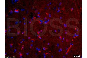 Formalin-fixed and paraffin-embedded human brain labeled with Rabbit Anti-NGAL Polyclonal Antibody, Unconjugated (ABIN685627) 1:200 followed by conjugation to the PE secondary antibody and DAPI staining (Lipocalin 2 Antikörper  (AA 101-198))