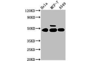 Western Blot Positive WB detected in: Hela whole cell lysate, MCF-7 whole cell lysate, A549 whole cell lysate All lanes: CSNK1G1 antibody at 3. (CSNK1G1 Antikörper  (Isoform gamma 1))