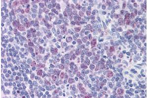 Human Tonsil: Formalin-Fixed, Paraffin-Embedded (FFPE)