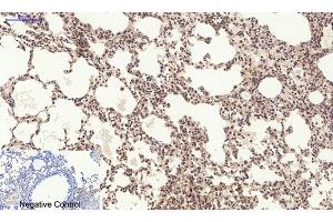 Immunohistochemical analysis of paraffin-embedded mouse lung tissue. (PERK Antikörper  (pThr981))