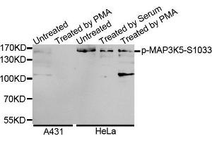 Western Blotting (WB) image for anti-Mitogen-Activated Protein Kinase Kinase Kinase 5 (MAP3K5) (pSer1033) antibody (ABIN3019485) (ASK1 Antikörper  (pSer1033))