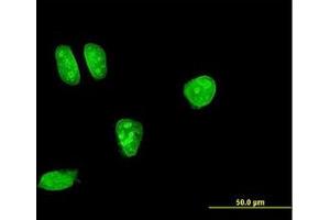 Image no. 2 for anti-Mitogen-Activated Protein Kinase Kinase 7 (MAP2K7) (AA 1-100) antibody (ABIN598899) (MAP2K7 Antikörper  (AA 1-100))