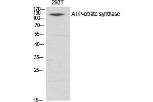 Western Blot (WB) analysis of specific cells using ATP-citrate synthase Polyclonal Antibody. (ACLY Antikörper  (Ser1227))