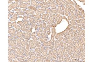 IHC analysis of BHMT using anti-BHMT antibody (ABIN7599940). (BHMT Antikörper  (AA 13-386))
