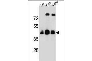 OR4C13 Antikörper  (N-Term)