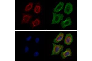 ABIN6262968 and ABIN6279515 staining Hela cells by IF/ICC.