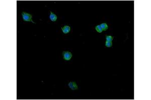 IF analysis of Clathrin heavy chain/CLTC using anti-Clathrin heavy chain/CLTC antibody (ABIN7602704). (Clathrin Heavy Chain (CLTC) (AA 967-1668) Antikörper)