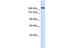 WB Suggested Anti-SMC2 Antibody Titration:  0. (SMC2 Antikörper  (Middle Region))