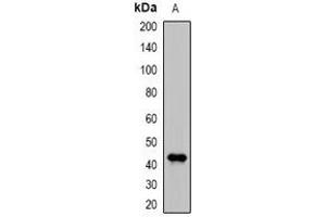 Western blot analysis of DDB2 expression in MCF7 (A) whole cell lysates. (DDB2 Antikörper)