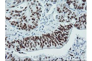 Image no. 3 for anti-Tumor Protein P53 (TP53) antibody (ABIN1499973) (p53 Antikörper)